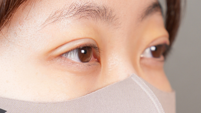 手術前の状態 その1