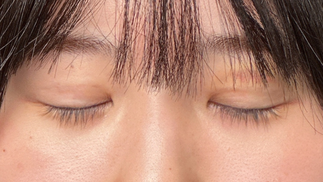 手术前的状态 其一