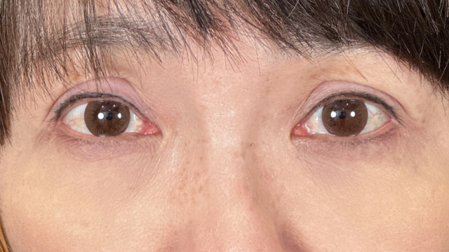 手术前的状态 其一