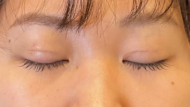 Postoperative Condition Part 1