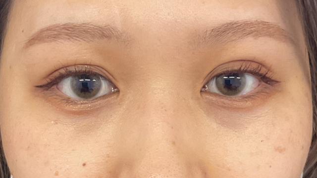 手术前的状态 其一