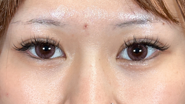 手术前的状态 其一