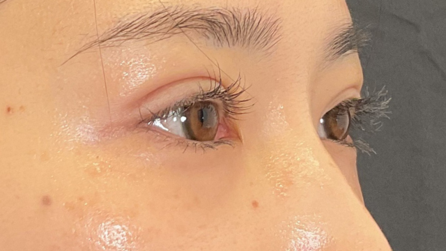 手术前的状态 其一