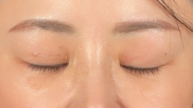 手术前的状态 其一