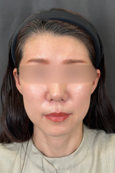 Postoperative Condition Part 1