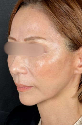 手術前の状態 その1