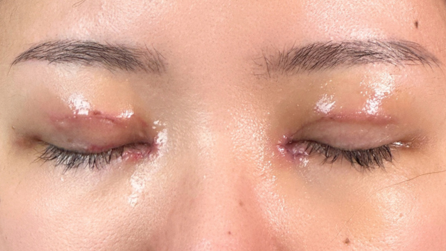 手術前の状態 その1