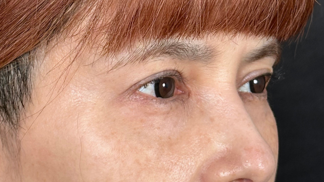 手术前的状态 其一