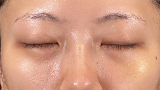 手术前的状态 其一