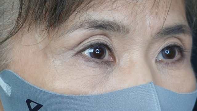 手术前的状态 其一