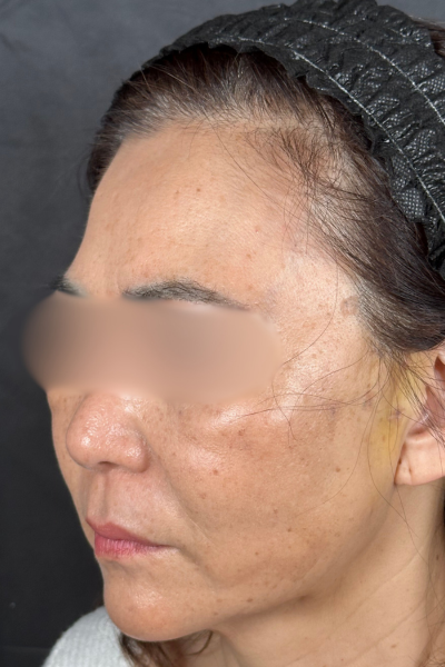 手術前の状態 その1