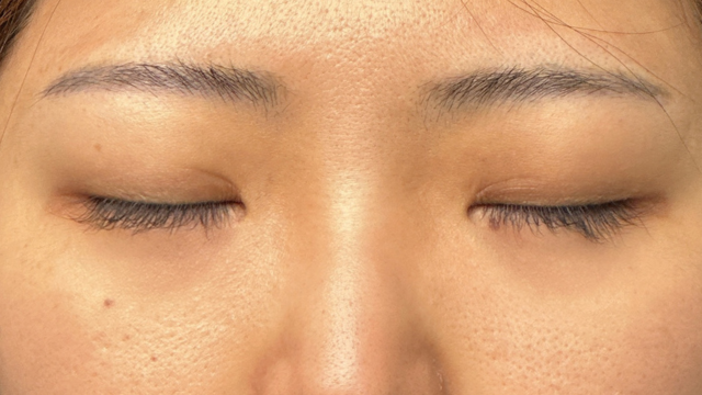 Postoperative Condition Part 1