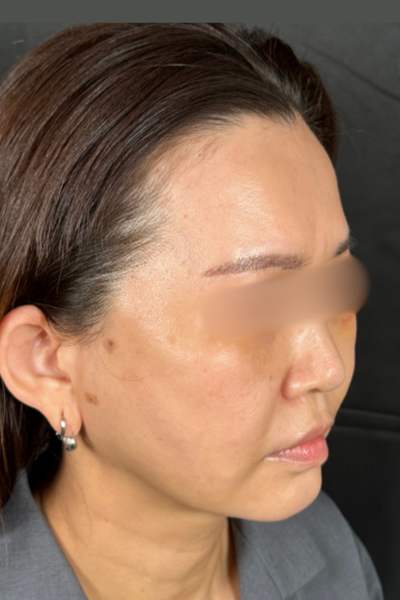 手术前的状态 其一