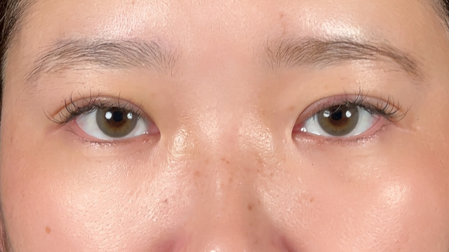 手术前的状态 其一