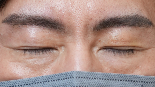 手术前的状态 其一