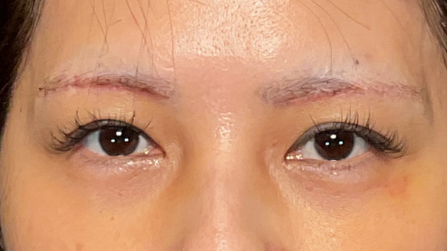 Postoperative Condition Part 1