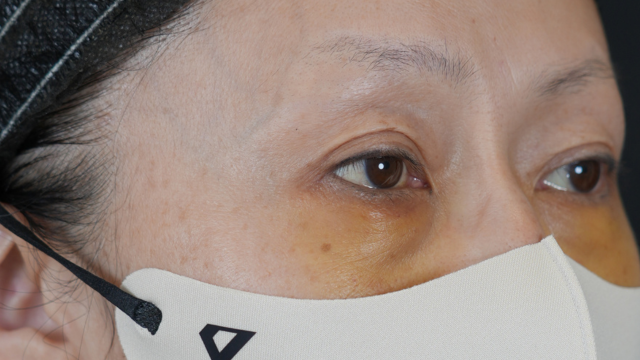 Postoperative Condition Part 1