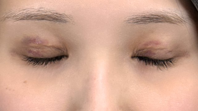 手术前的状态 其一