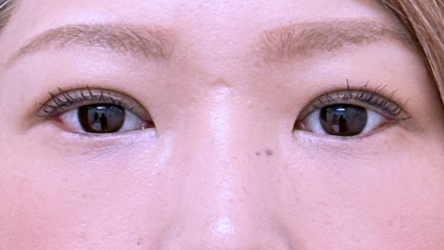 Postoperative Condition Part 1