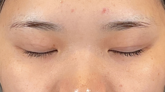 手術前の状態 その1