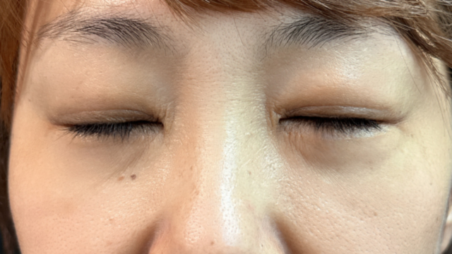 Postoperative Condition Part 1