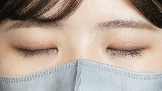 手术前的状态 其一