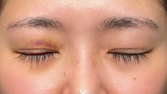 手术前的状态 其一