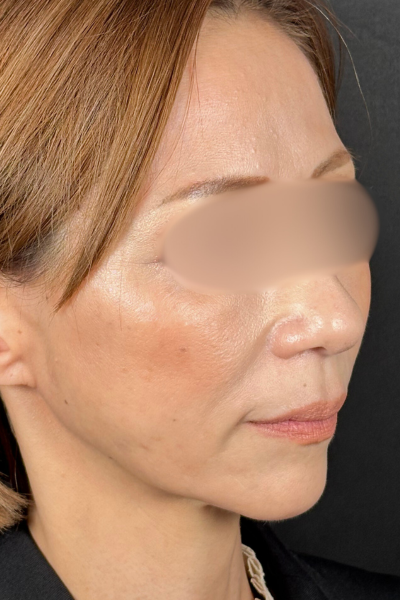 手術前の状態 その1