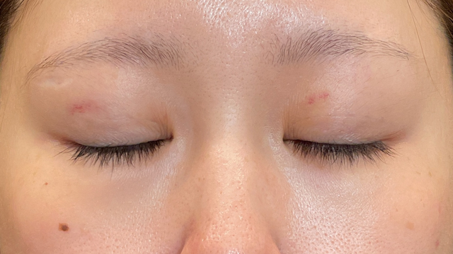 Postoperative Condition Part 1