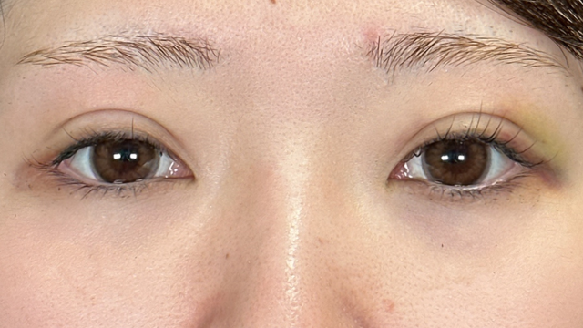 手术前的状态 其一