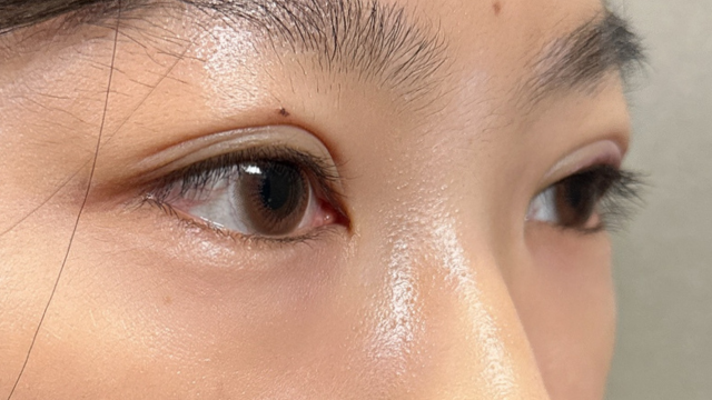 手术前的状态 其一