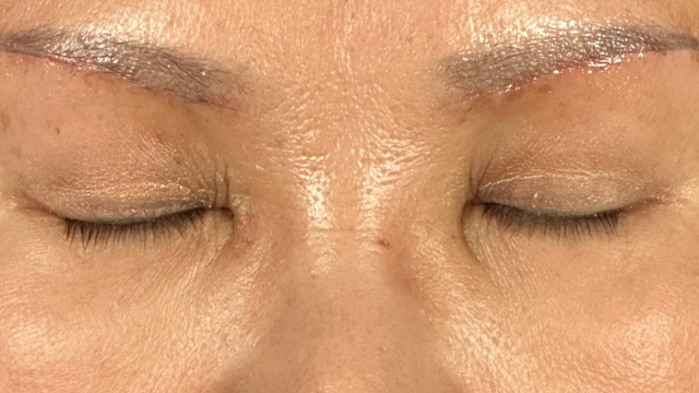 Postoperative Condition Part 1