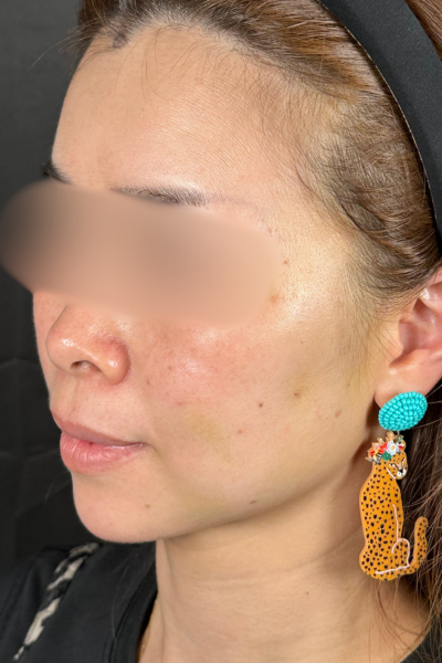 手术前的状态 其一