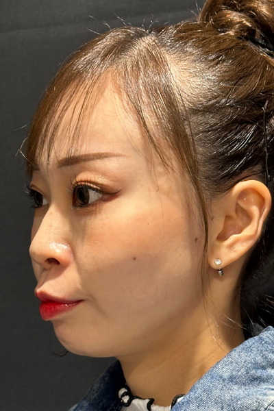 手术前的状态 其一