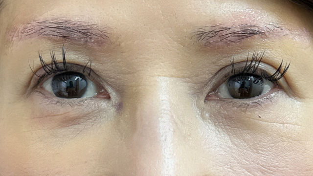 Postoperative Condition Part 1