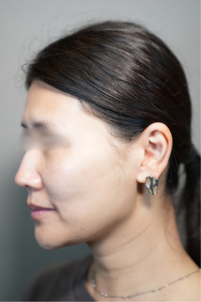 手術前の状態 その1