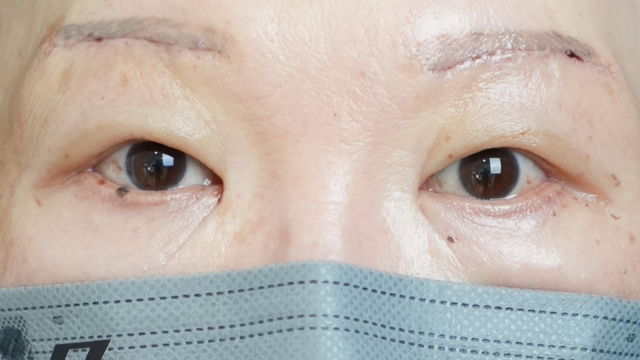 Postoperative Condition Part 1