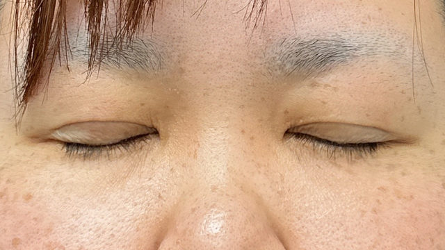 Postoperative Condition Part 1