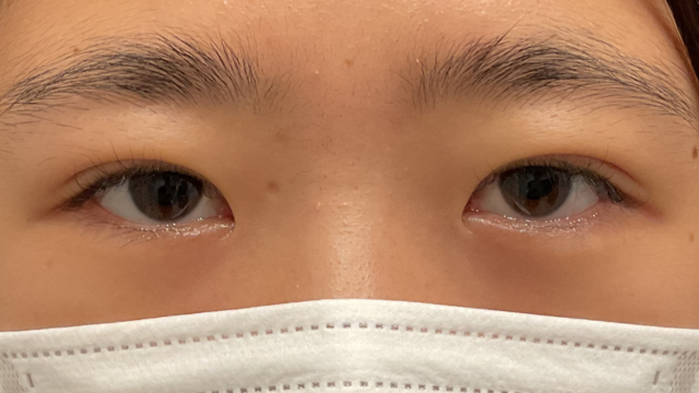 Postoperative Condition Part 1