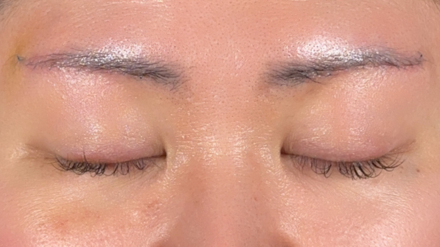 Postoperative Condition Part 1