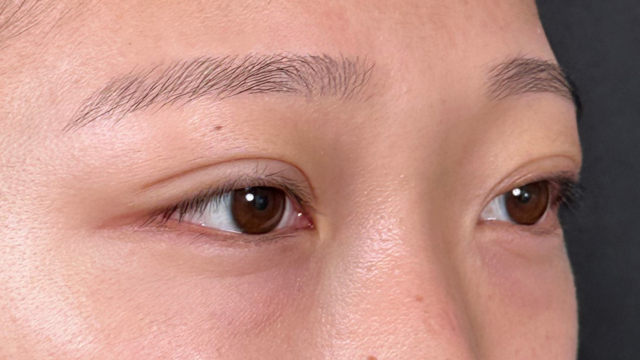 手術前の状態 その1