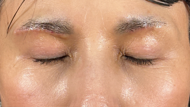 手術前の状態 その1