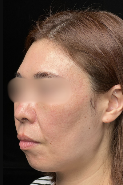 手術前の状態 その1