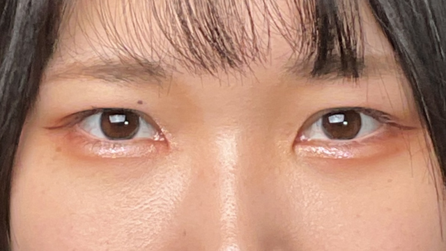 Postoperative Condition Part 1