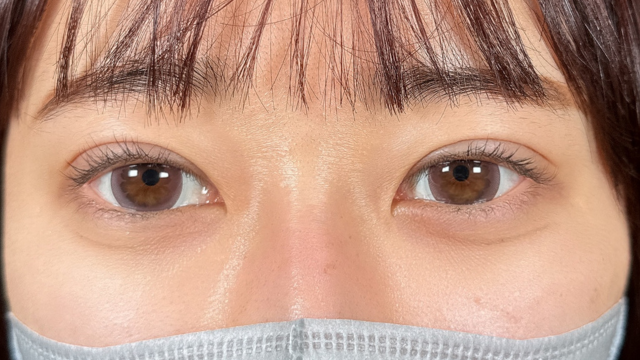 手术前的状态 其一