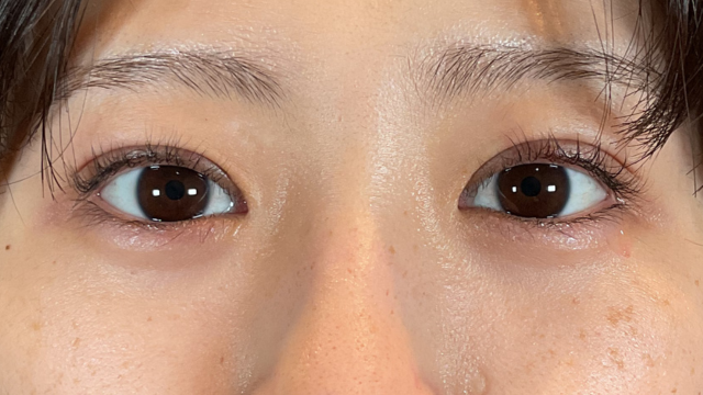 手术前的状态 其一