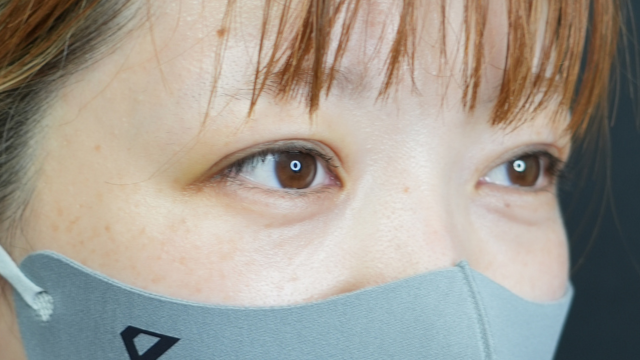 手术前的状态 其一