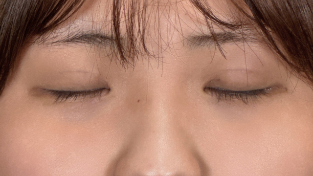 手术前的状态 其一