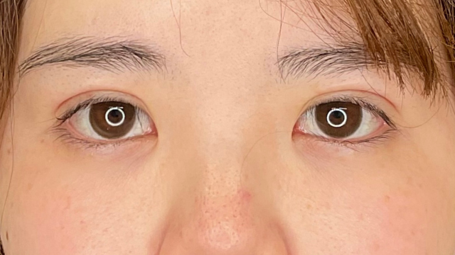 手术前的状态 其一