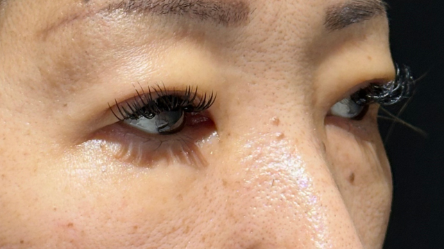 手术前的状态 其一